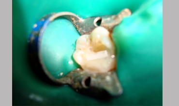 Dental care in Anand
                        